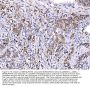 Anti-MIRO1/RHOT1 Antibody PicobandÂ®