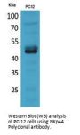 Anti-NKp44 NCR2 Antibody