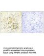 Anti-TMEPA PMEPA1 Antibody