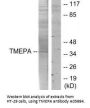 Anti-TMEPA PMEPA1 Antibody