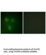 Anti-TMEPA PMEPA1 Antibody