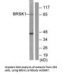 Anti-BRSK1 Antibody