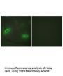 Anti-TNFSF9/Cd137L Antibody
