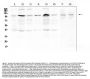 Anti-RSK3/RPS6KA2 Antibody Picoband®