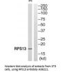 Anti-RPS13/Ribosomal Protein S13 Antibody