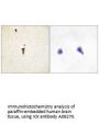 Anti-ICK Antibody