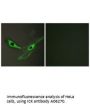 Anti-ICK Antibody
