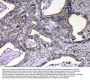 Anti-NOV/CCN3 Antibody PicobandÂ®