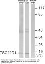Anti-TSC22 domain family protein 1 TSC22D1 Antibody