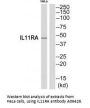 Anti-IL11RA Antibody