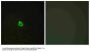 Anti-RECK Antibody