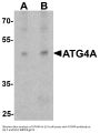Anti-Cysteine protease ATG4A ATG4A Antibody
