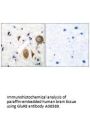 Anti-GluR8 GRM8 Antibody