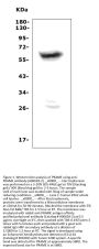 Anti-PRAME Picoband® Antibody