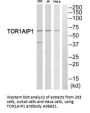 Anti-TOR1AIP1/Lap1B Antibody