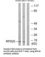 Anti-RPS20/Ribosomal Protein S20 Antibody
