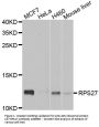 Anti-40S ribosomal protein S27 RPS27 Antibody