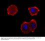 Anti-NEFM Antibody