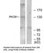 Anti-PKCB1 ZMYND8 Antibody