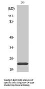 Anti-Na+ CP type II beta SCN2B Antibody