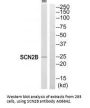 Anti-Sodium channel subunit beta-2 SCN2B Antibody