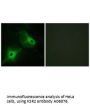 Anti-Kinase suppressor of Ras 2 KSR2 Antibody
