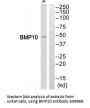 Anti-Bone morphogenetic protein 10 BMP10 Antibody