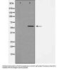 Anti-RPL30/Ribosomal Protein L30 Antibody
