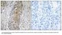 Anti-SAA4/Serum Amyloid A4 Antibody