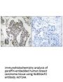 Anti-RAB3GAP2 Antibody