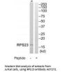 Anti-RPS23/Ribosomal Protein S23 Antibody