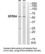 Anti-SFRS4 SRSF4 Antibody