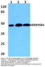 Anti-Serpin B4 SERPINB4 Antibody