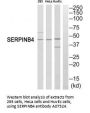 Anti-Serpin B4 SERPINB4 Antibody