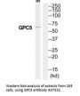 Anti-GPC5/Glypican 5 Antibody