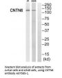 Anti-CNTN6/Contactin 6 Antibody