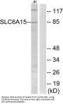 Anti-SLC6A15 Antibody