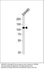 Anti-MAP3K9 Antibody (N-term)