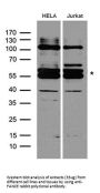 Anti-FANCE Rabbit Polyclonal Antibody