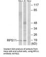 Anti-40S ribosomal protein S11 RPS11 Antibody