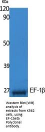 Anti-EF-1 beta EEF1B2 Antibody