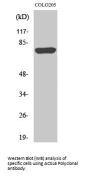 Anti-ACSL6 Antibody