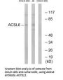 Anti-ACSL6 Antibody
