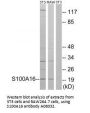 Anti-Protein S100-A16 S100A16 Antibody