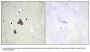 Anti-ADCY8/Adenylate Cyclase 8 Antibody