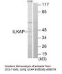 Anti-ILKAP/Pp2C Delta Antibody