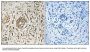 Anti-CIB2 Antibody
