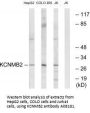 Anti-KCNMB2 Antibody