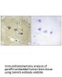 Anti-CAMK5 CAMKV Antibody