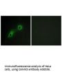 Anti-CAMK5 CAMKV Antibody